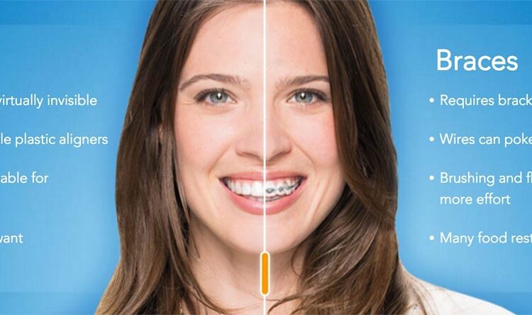 Invisalign Vs. Braces: Which is the Best Option for You?